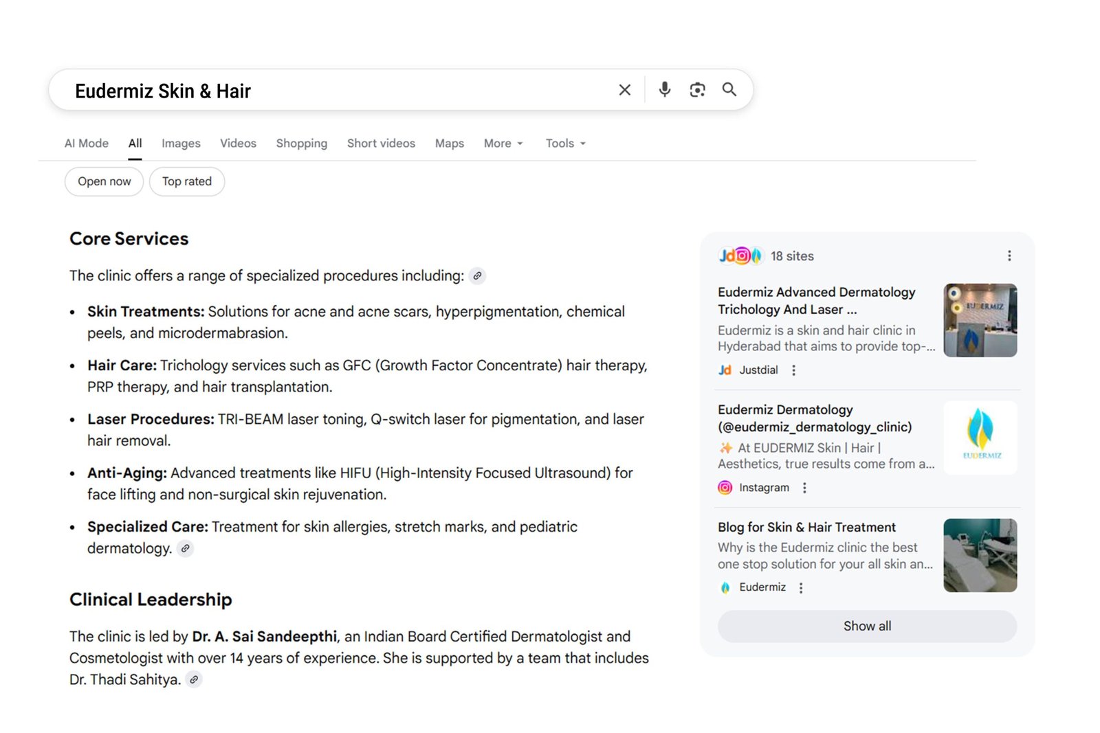 Vulcan Solar Answer Engine Optimization